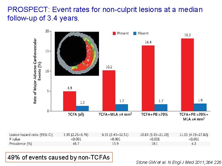 PROSPECT: Event rates for non-culprit lesions at a median follow-up of 3. 4 years.