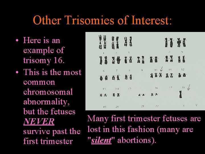 Other Trisomies of Interest: • Here is an example of trisomy 16. • This
