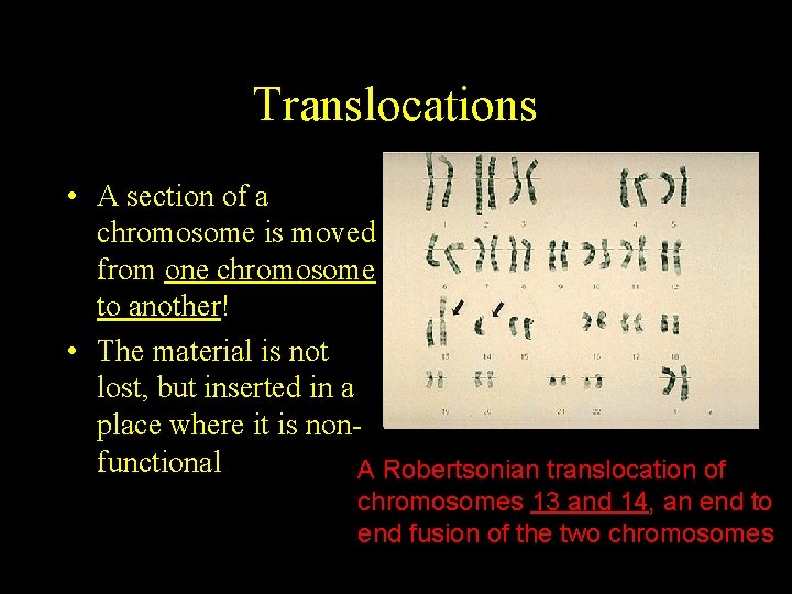 Translocations • A section of a chromosome is moved from one chromosome to another!