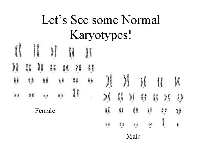 Let’s See some Normal Karyotypes! Female Male 