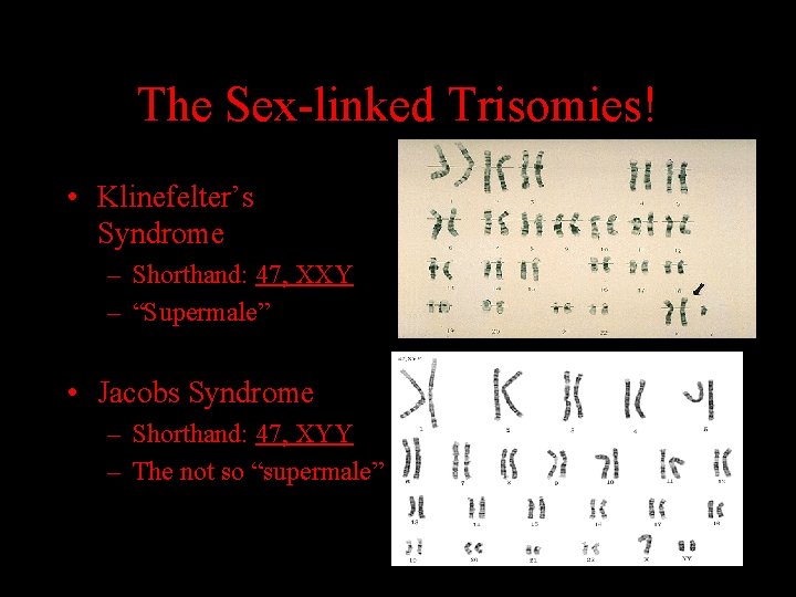 The Sex-linked Trisomies! • Klinefelter’s Syndrome – Shorthand: 47, XXY – “Supermale” • Jacobs