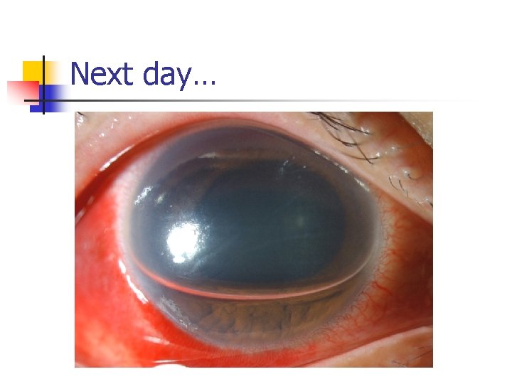 Next day… 