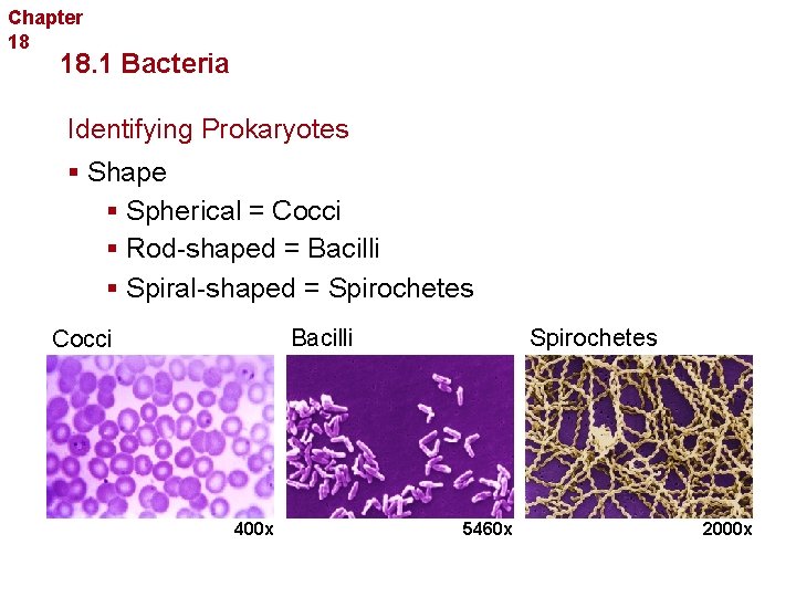 Chapter 18 Bacteria and Viruses 18. 1 Bacteria Identifying Prokaryotes § Shape § Spherical