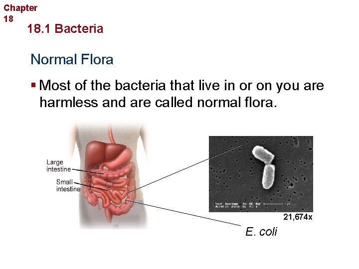 Chapter 18 Bacteria and Viruses 18. 1 Bacteria Normal Flora § Most of the