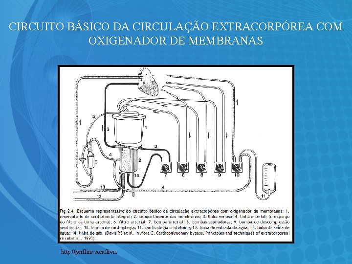 CIRCUITO BÁSICO DA CIRCULAÇÃO EXTRACORPÓREA COM OXIGENADOR DE MEMBRANAS http: //perfline. com/livro 