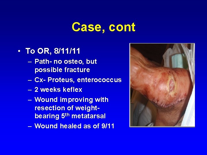 Case, cont • To OR, 8/11/11 – Path- no osteo, but possible fracture –