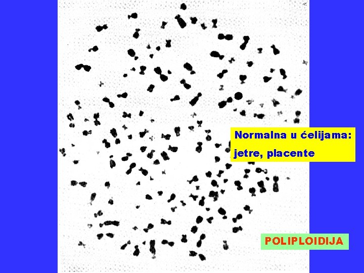 Normalna u ćelijama: jetre, placente POLIPLOIDIJA 