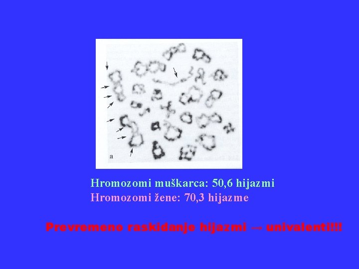 Hromozomi muškarca: 50, 6 hijazmi Hromozomi žene: 70, 3 hijazme Prevremeno raskidanje hijazmi →