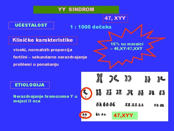 YY SINDROM 47, XYY UČESTALOST 1 : 1000 dečaka Kliničke karakteristike visoki, normalnih proporcija