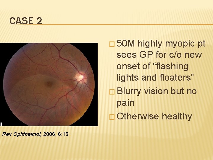 CASE 2 � 50 M highly myopic pt sees GP for c/o new onset