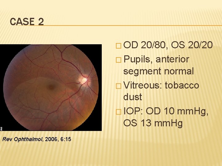 CASE 2 � OD 20/80, OS 20/20 � Pupils, anterior segment normal � Vitreous: