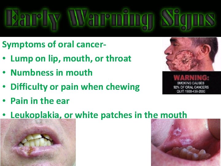 Symptoms of oral cancer • Lump on lip, mouth, or throat • Numbness in