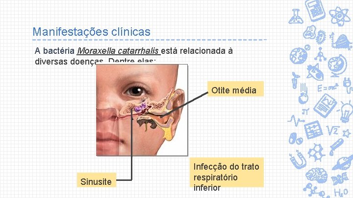 Manifestações clínicas A bactéria Moraxella catarrhalis está relacionada à diversas doenças. Dentre elas: Otite