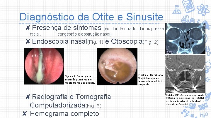 Diagnóstico da Otite e Sinusite ✘Presença de sintomas (ex: dor de ouvido, dor ou