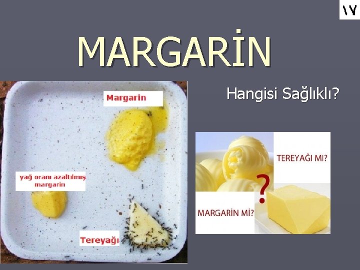 MARGARİN Hangisi Sağlıklı? 