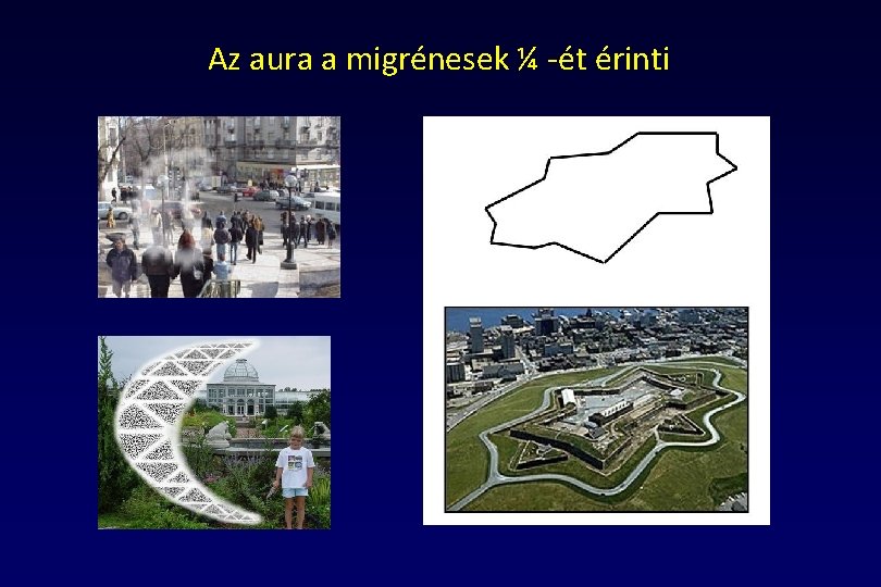 Az aura a migrénesek ¼ -ét érinti 