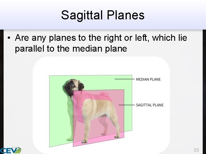Sagittal Planes • Are any planes to the right or left, which lie parallel