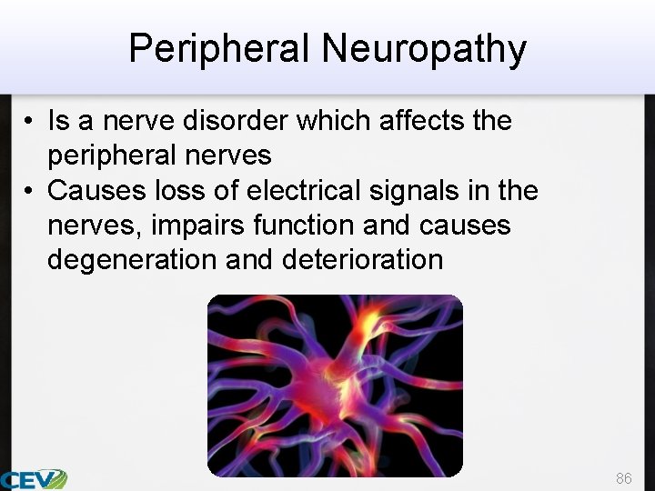 Peripheral Neuropathy • Is a nerve disorder which affects the peripheral nerves • Causes