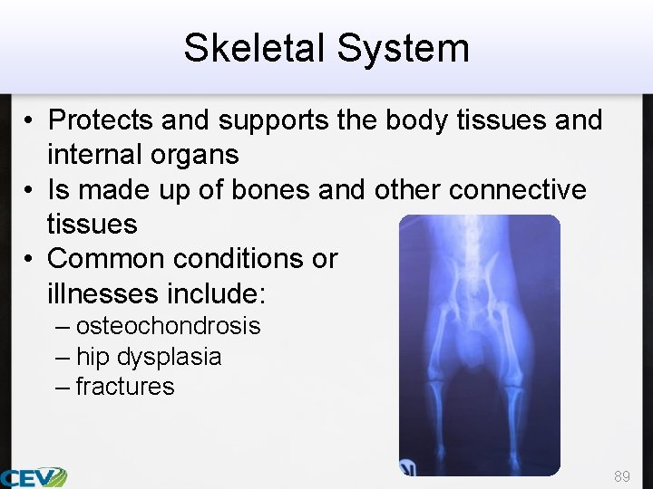 Skeletal System • Protects and supports the body tissues and internal organs • Is