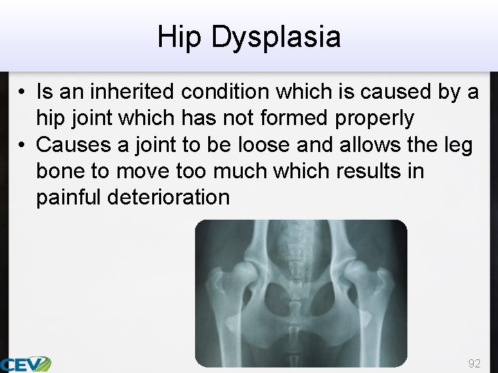 Hip Dysplasia • Is an inherited condition which is caused by a hip joint