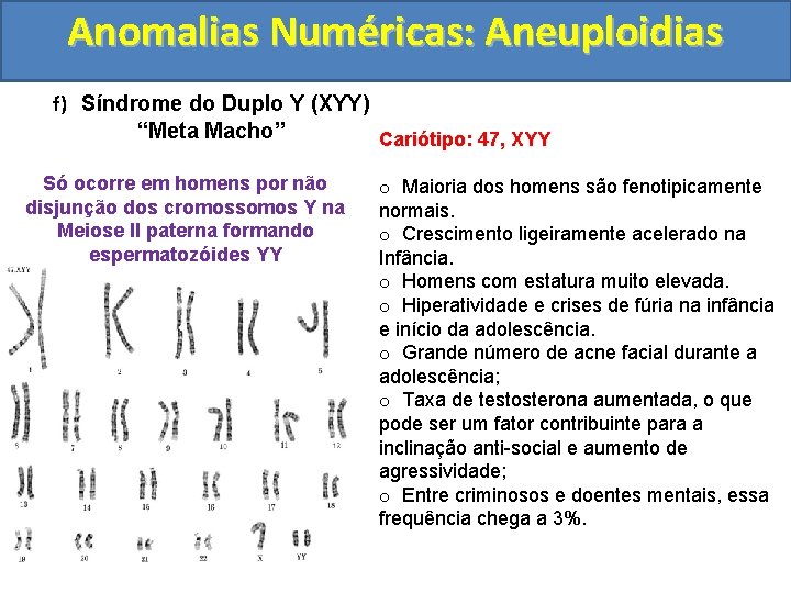 Anomalias Numéricas: Aneuploidias f) Síndrome do Duplo Y (XYY) “Meta Macho” Cariótipo: 47, XYY