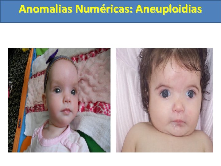 Anomalias Numéricas: Aneuploidias 