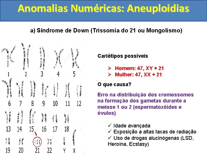 Anomalias Numéricas: Aneuploidias a) Síndrome de Down (Trissomia do 21 ou Mongolismo) Cariótipos possíveis