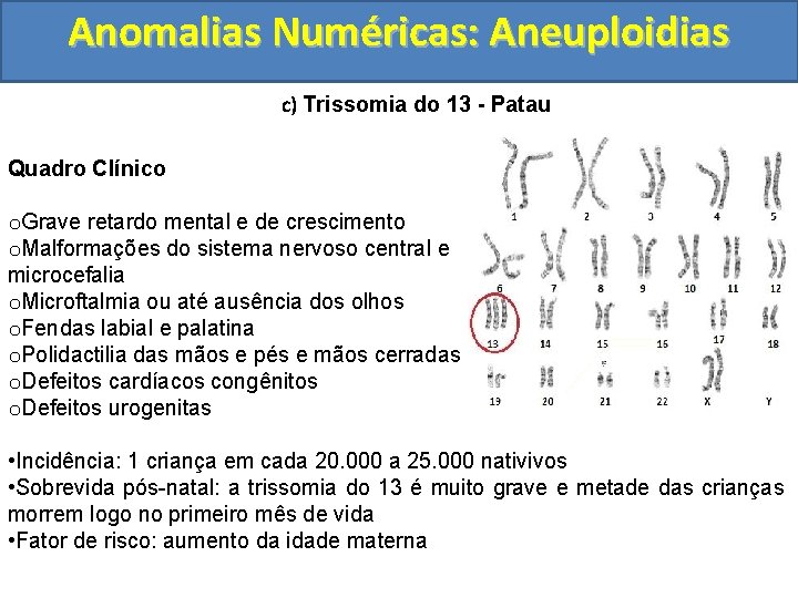 Anomalias Numéricas: Aneuploidias c) Trissomia do 13 - Patau Quadro Clínico o. Grave retardo