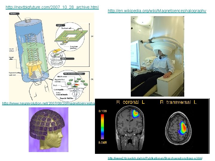http: //nextbigfuture. com/2007_10_28_archive. html http: //en. wikipedia. org/wiki/Magnetoencephalography http: //www. neurevolution. net/2007/08/20/magnetoencephalography/ http: //www