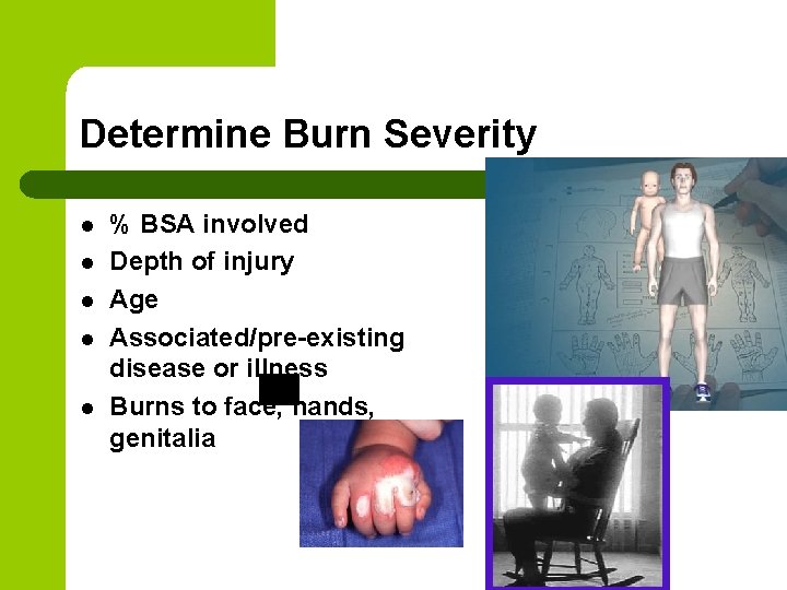 Determine Burn Severity l l l % BSA involved Depth of injury Age Associated/pre-existing