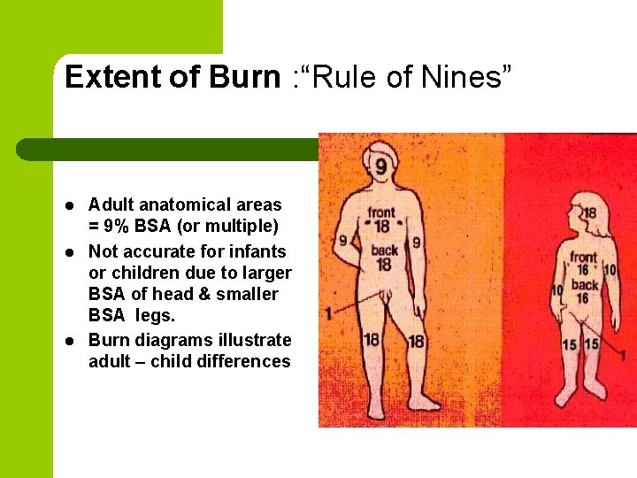 Extent of Burn : “Rule of Nines” l l l Adult anatomical areas =