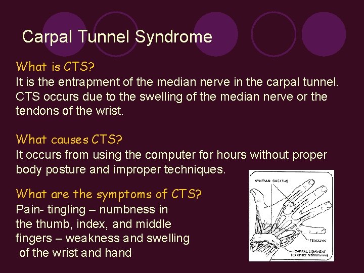 Carpal Tunnel Syndrome What is CTS? It is the entrapment of the median nerve