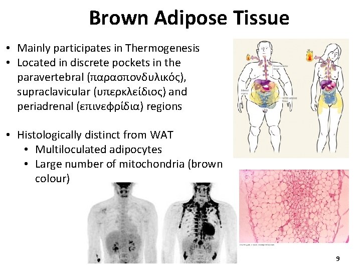 Brown Adipose Tissue • Mainly participates in Thermogenesis • Located in discrete pockets in