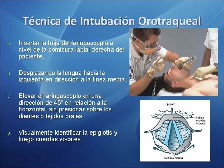 Técnica de Intubación Orotraqueal 5. Insertar la hoja del laringoscopio a nivel de la Técnica de Intubación Orotraqueal 5. Insertar la hoja del laringoscopio a nivel de la