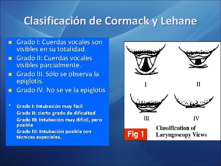 Clasificación de Cormack y Lehane n n Grado I: Cuerdas vocales son visibles en