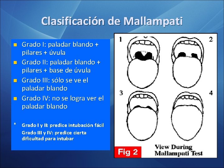 Clasificación de Mallampati n n Grado I: paladar blando + pilares + úvula Grado Clasificación de Mallampati n n Grado I: paladar blando + pilares + úvula Grado