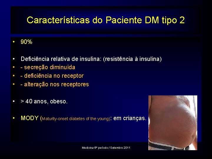 Características do. TIPO Paciente DM tipo 2 DM 2 • 90% • • Deficiência