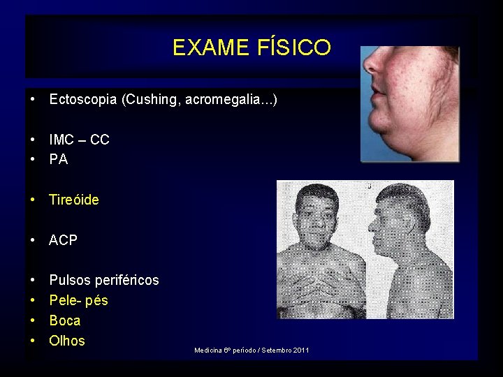 EXAME FÍSICO • Ectoscopia (Cushing, acromegalia. . . ) • IMC – CC •