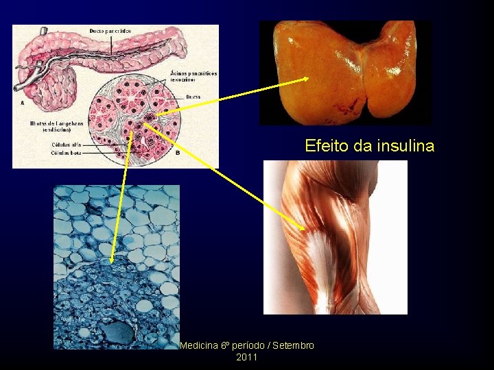 Efeito da insulina Medicina 6º período / Setembro 2011 