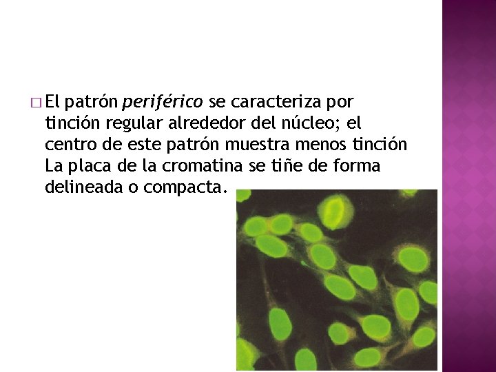 � El patrón periférico se caracteriza por tinción regular alrededor del núcleo; el centro