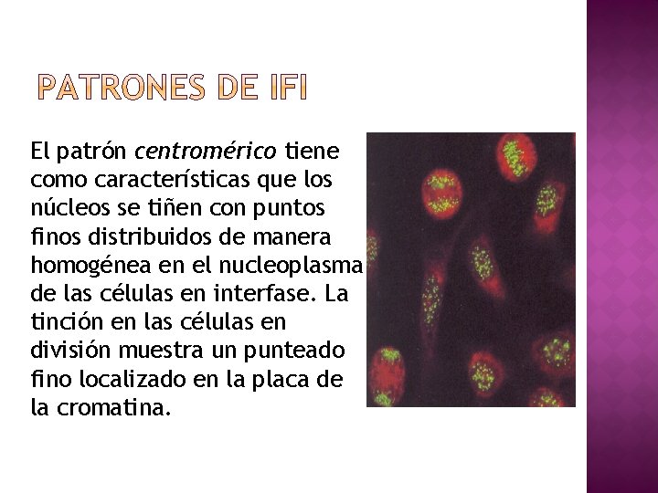 El patrón centromérico tiene como características que los núcleos se tiñen con puntos finos