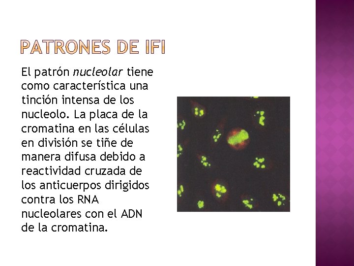 El patrón nucleolar tiene como característica una tinción intensa de los nucleolo. La placa
