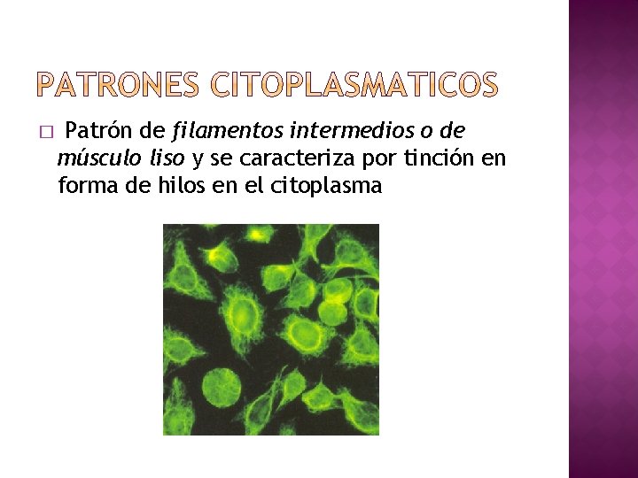 � Patrón de filamentos intermedios o de músculo liso y se caracteriza por tinción