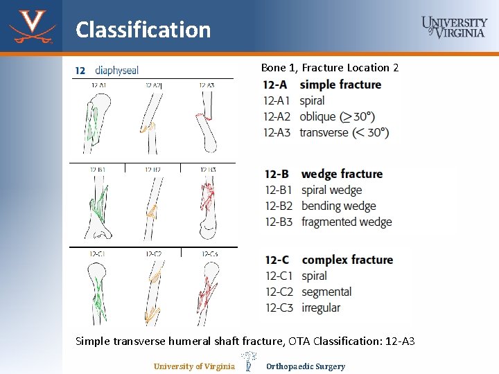 Classification Bone 1, Fracture Location 2 Simple transverse humeral shaft fracture, OTA Classification: 12