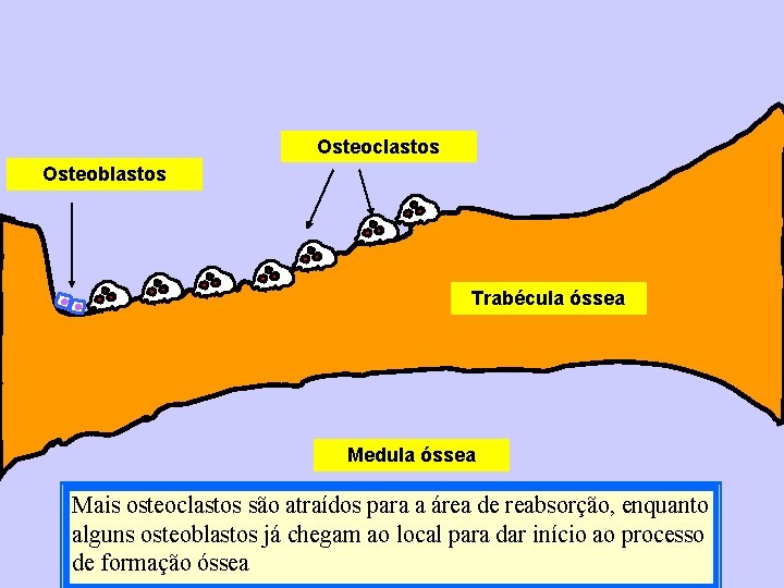 Osteoclastos Osteoblastos Trabécula óssea Medula óssea Mais osteoclastos são atraídos para a área de