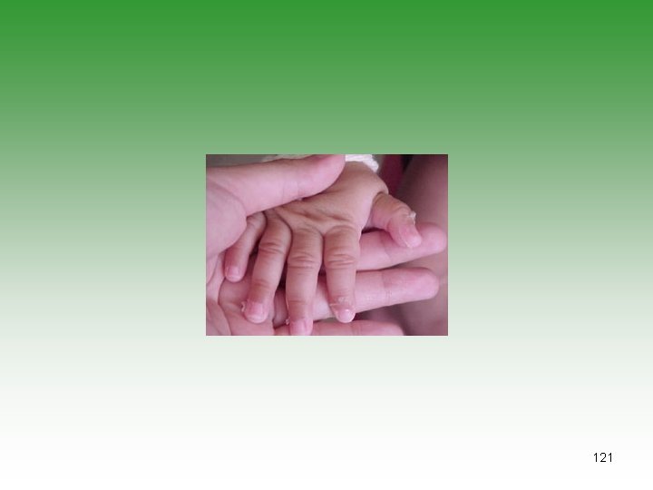 121 