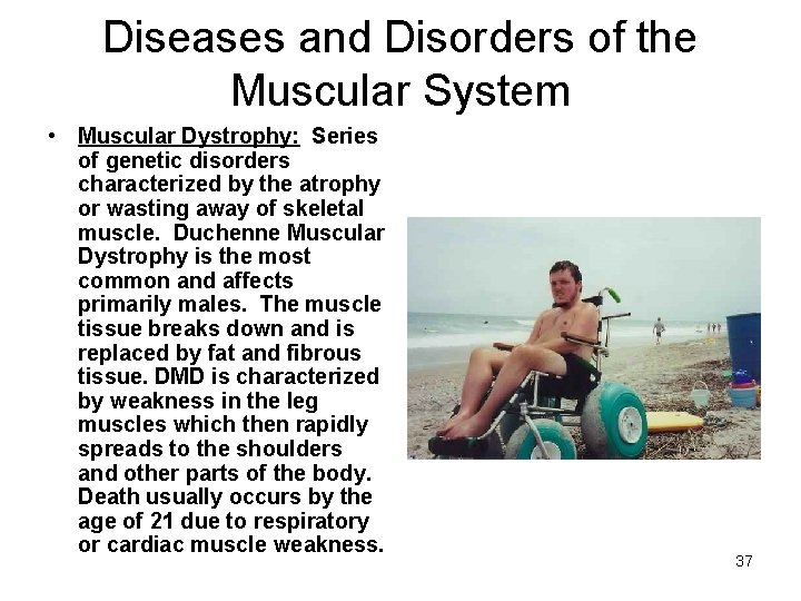 Diseases and Disorders of the Muscular System • Muscular Dystrophy: Series of genetic disorders