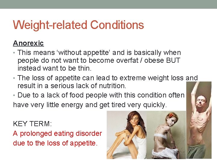 Weight-related Conditions Anorexic • This means ‘without appetite’ and is basically when people do