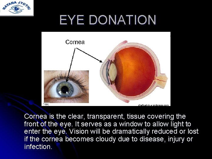 EYE DONATION chefcalvin. wordpress. com Cornea is the clear, transparent, tissue covering the front