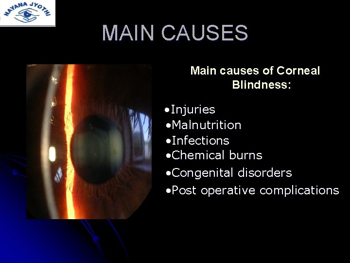 MAIN CAUSES Main causes of Corneal Blindness: • Injuries • Malnutrition • Infections •